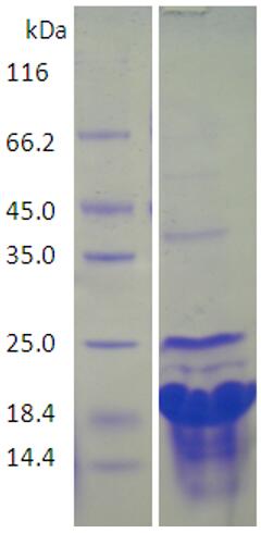 15% SDS-PAGE analysis profiles of purified KP1_0355-22-117 (CBB stained).
